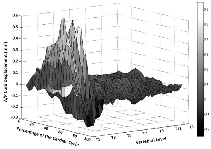 Fig 3.