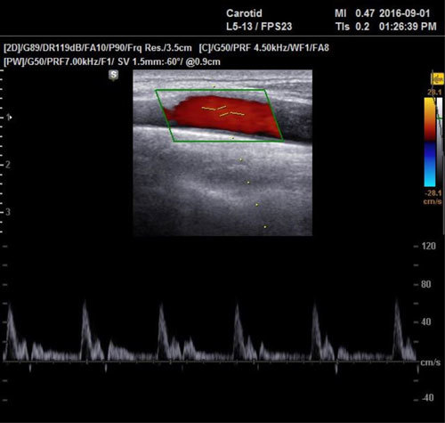 Figure 4