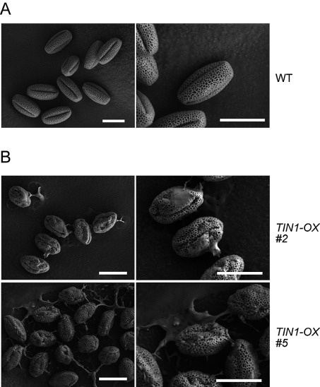 Figure 3. SEM observation of pollen grains of TIN1-OX plants. (A) SEM images of pollen grains of wild-type plants. (B) SEM images of pollen grains of TIN1-OX plants. Images from two independent TIN1-OX lines (#2 and #5) were shown. Bar=20 µm.