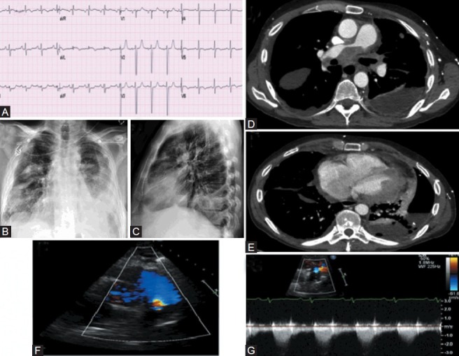 Figure 14