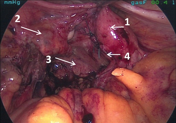 Figure 3