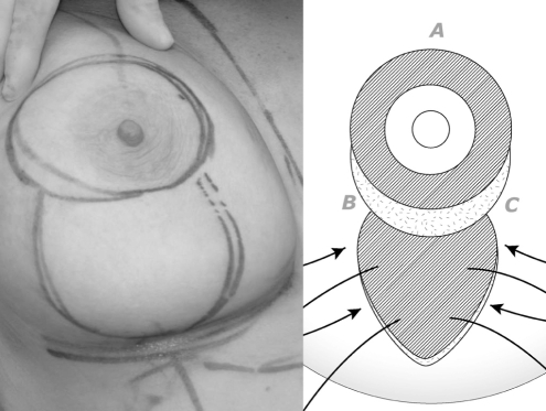 Figure 1)