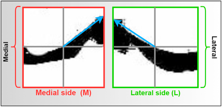 Fig. 16