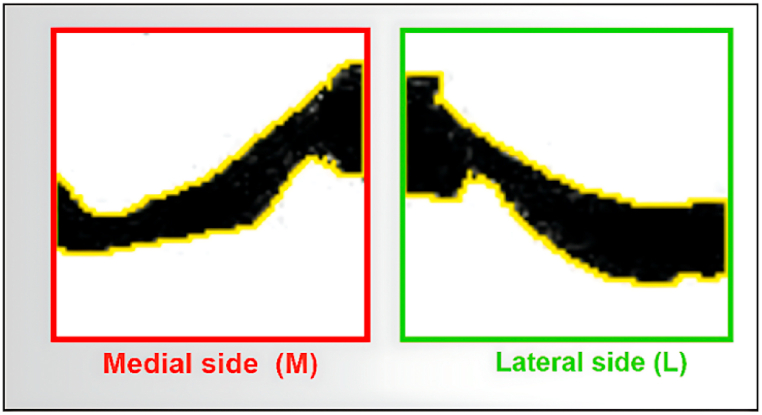 Fig. 15