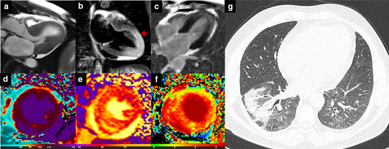 Fig. 6