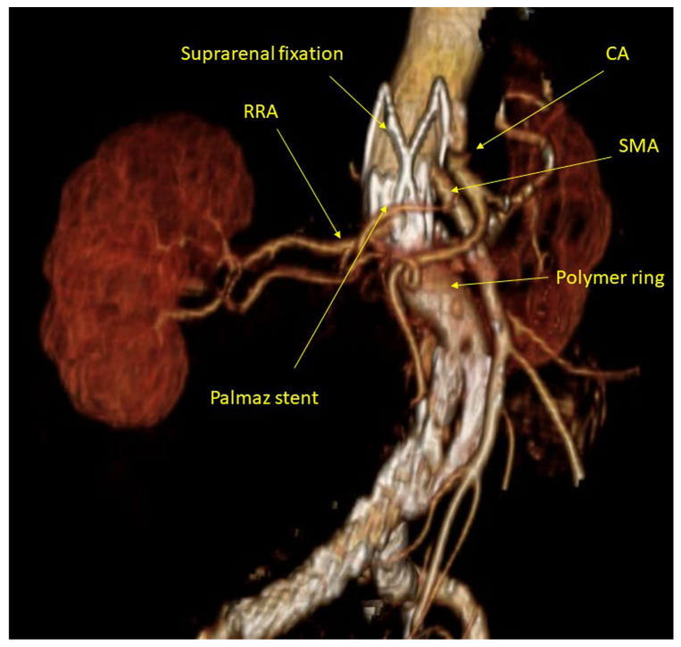 Fig 1