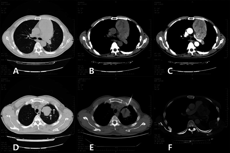 FIGURE 2