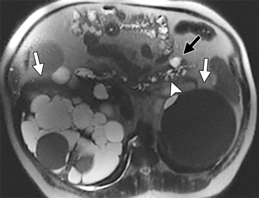 Figure 4a: