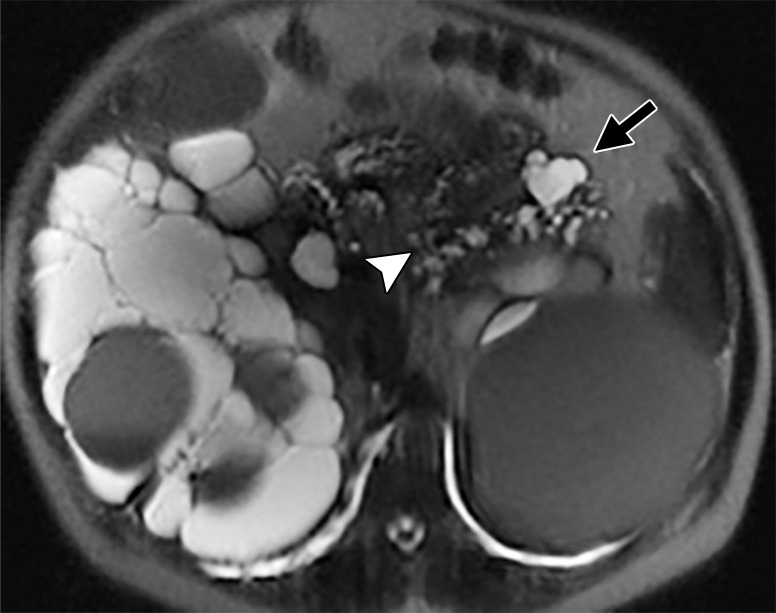 Figure 4b: