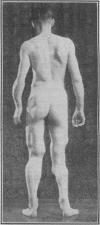 224