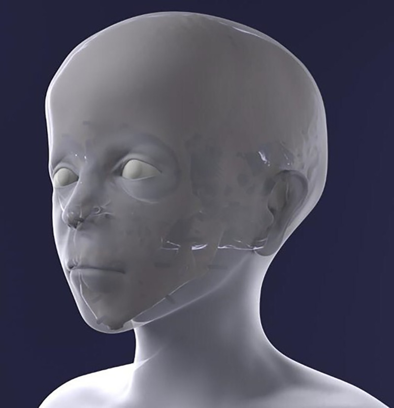 Fig 14