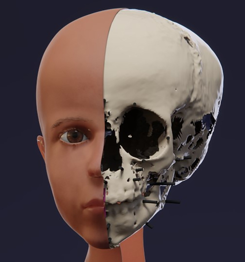 Fig 11