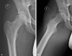 Fig. 1A–B