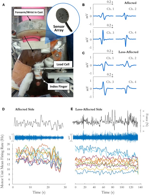 FIGURE 1