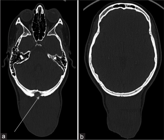 Figure 3: