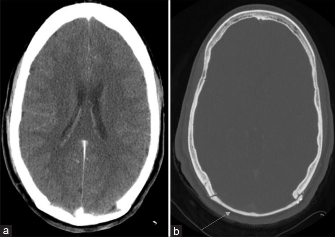 Figure 4: