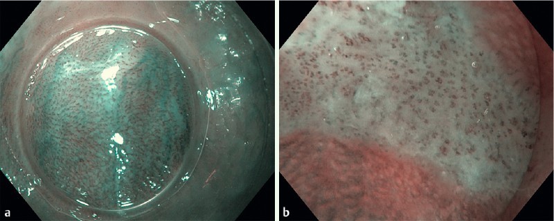 Fig. 1 a