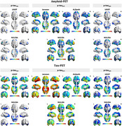 graphic file with name ALZ-20-e094671-g001.jpg