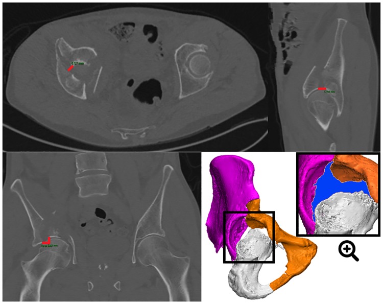 Fig 3