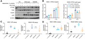 Figure 4. FAK phosphorylation, ROS, and DDR are differentially affected by TP53 status in HPV-negative HNSCC. A, Western blots of the indicated proteins from UM-SCC-1 cells forced to express wild-type or mutant (G245D) p53 treated with 1.0 μmol/L defactinib and ionizing radiation (2 Gy). B, ROS production in mutant TP53 HN31 and wild-type TP53 HN30 cells following treatment with defactinib and ionizing radiation (2 Gy) measured via DCF-ROS flow cytometry assay. C and D, I-Scel assay for HR (C) and NHEJ (D) in mutant TP53 HN31 and wild-type TP53 HN30 cells following treatment of defactinib. HR, homologous recombination; NHEJ, nonhomologous end joining. ANOVA with correction for multiple comparisons was used. *, two-sided P < 0.01.