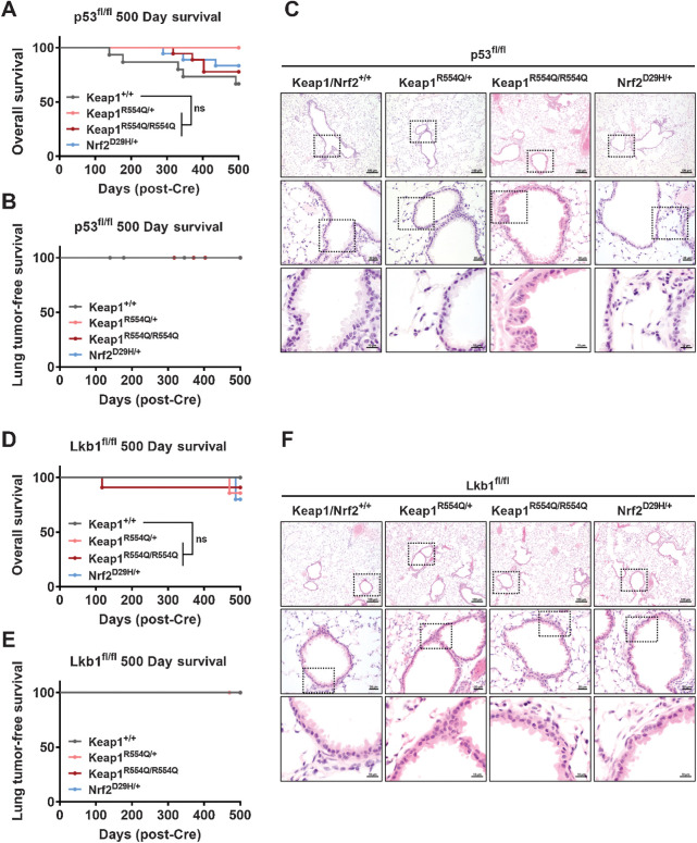 Figure 3. Mutation of Keap1 or Nrf2 is not sufficient to initiate lung tumorigenesis with p53 or Lkb1 loss. A, Overall survival of p53fl/fl mice expressing WT or mutant Keap1/Nrf2. Keap1/Nrf2+/+ (n = 15); Keap1R554Q/+ (n = 7); Keap1R554Q/R554Q (n = 18); Nrf2D29H/+ (n = 18). ns, not significant [log-rank (Mantel–Cox) test]. B, Lung tumor-free survival of p53fl/fl mice expressing WT or mutant Keap1/Nrf2. Keap1/Nrf2+/+ (n = 11); Keap1R554Q/+ (n = 6); Keap1R554Q/R554Q (n = 16); Nrf2D29H/+ (n = 10). C, Representative hematoxylin and eosin staining of mouse lung depicting bronchiolar and alveolar cells of the p53fl/fl models. Scale bars, 100 μm (top), 20 μm (middle), and 10 μm (bottom). D, Overall survival of Lkb1fl/fl mice expressing WT or mutant Keap1/Nrf2. Keap1/Nrf2+/+ (n = 11); Keap1R554Q/+ (n = 7); Keap1R554Q/R554Q (n = 11); Nrf2D29H/+ (n = 5). ns, not significant [log-rank (Mantel–Cox) test]. E, Lung tumor-free survival of Lkb1fl/fl mice expressing WT or mutant Keap1/Nrf2. Keap1/Nrf2+/+ (n = 11); Keap1R554Q/+ (n = 6); Keap1R554Q/R554Q (n = 9); Nrf2D29H/+ (n = 4). F, Representative hematoxylin and eosin staining of mouse lung depicting bronchiolar and alveolar cells of the Lkb1fl/fl models. Scale bars, 100 μm (top), 20 μm (middle), and 10 μm (bottom). A, B, D, and E, Mice were infected intranasally with adenoviral-Cre, followed by collection at 500 days to analyze lung tissue histology.