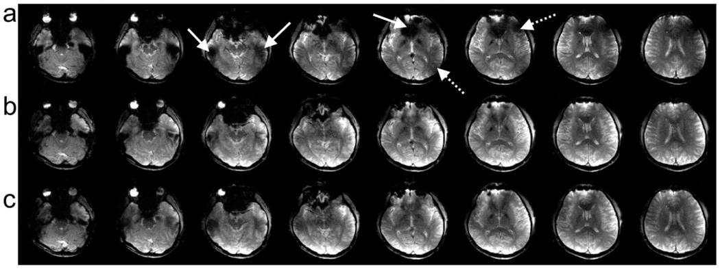 FIG. 6