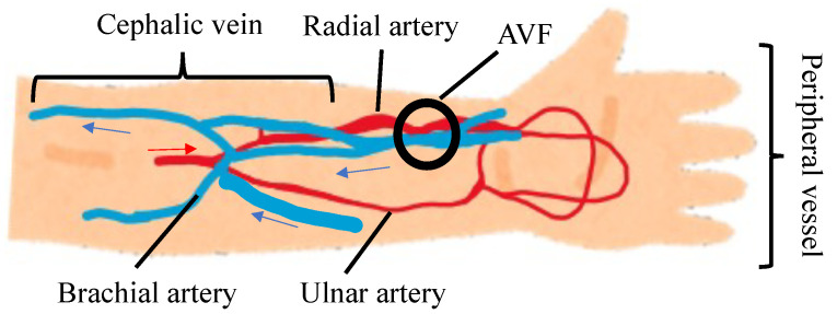 Figure 18