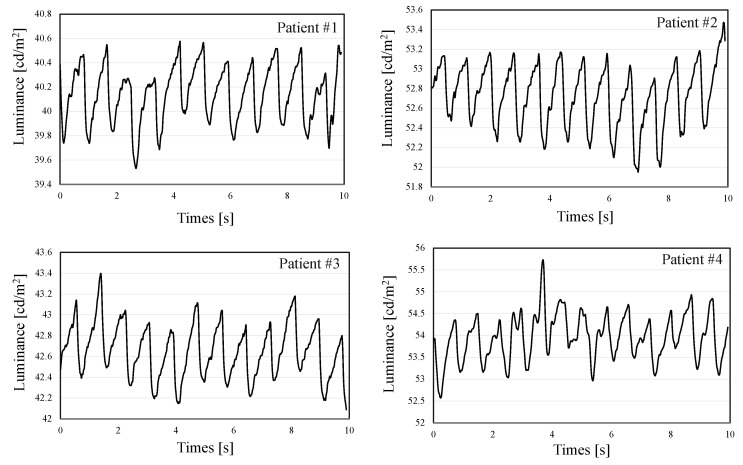 Figure 14