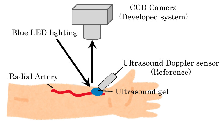 Figure 9