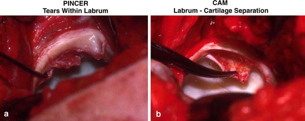 Fig. 14