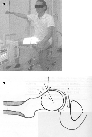 Fig. 20