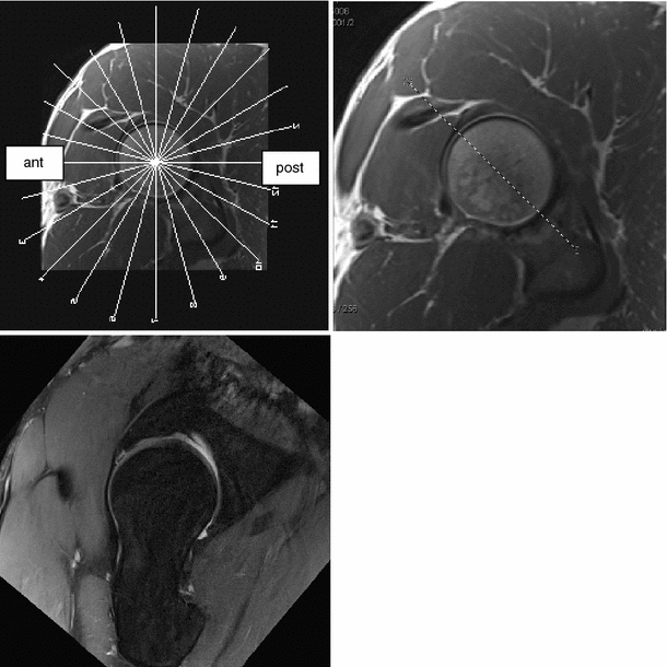 Fig. 21