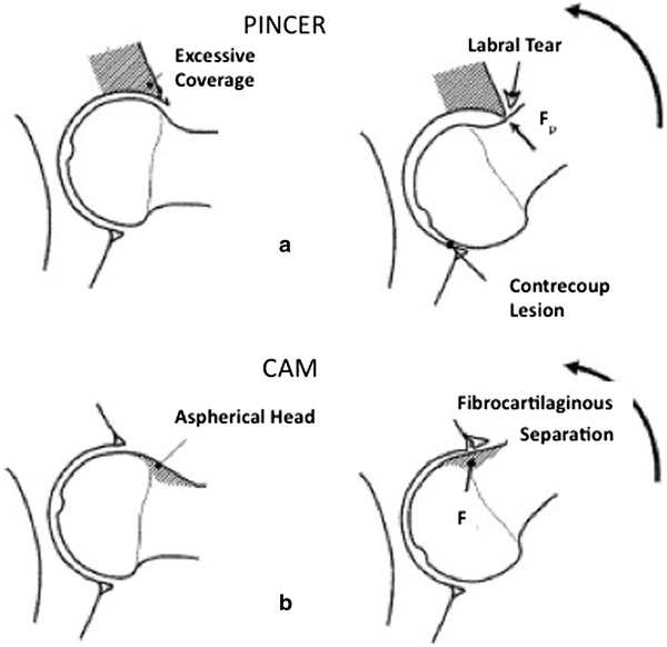 Fig. 12