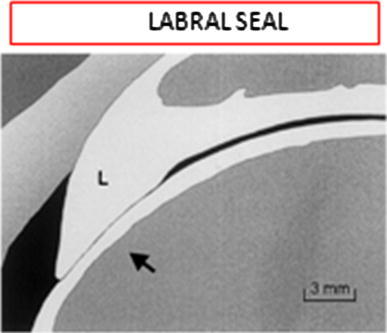 Fig. 11