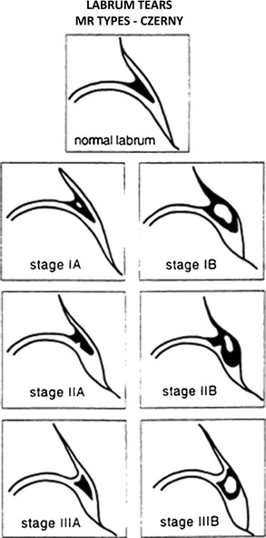 Fig. 15