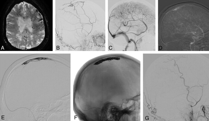 Fig 3.