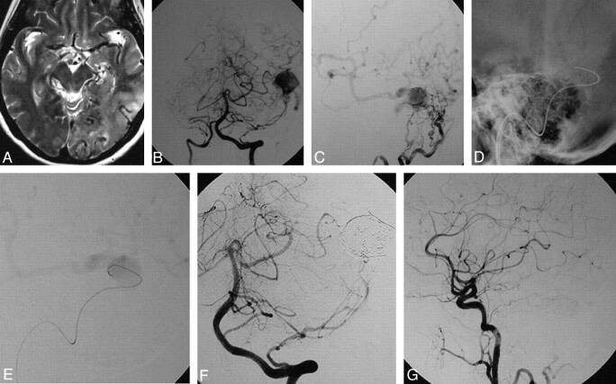 Fig 2.