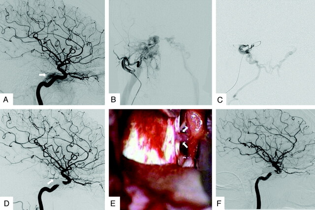 Fig 4.