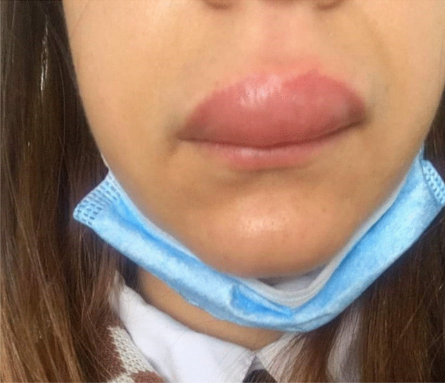 Fig. 3
