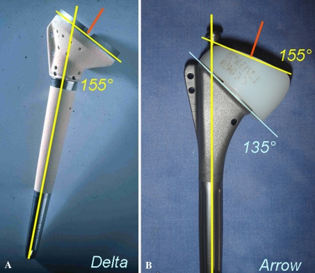 Fig. 2A–B