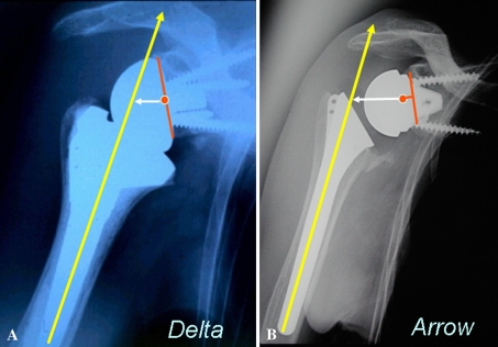 Fig. 3A–B