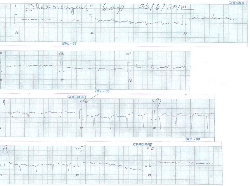 Figure 2