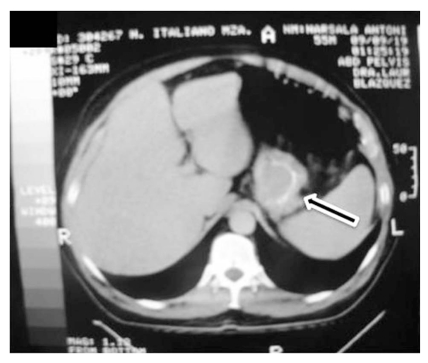 Fig. (2b)