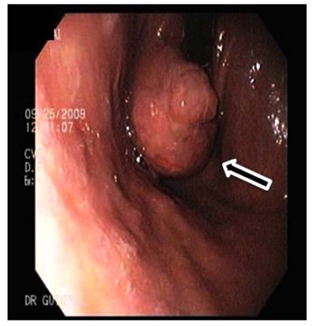 Fig. (3a)