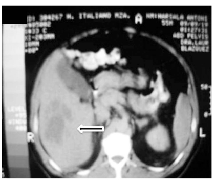 Fig. (2a)