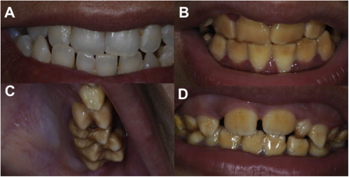 Figure 1