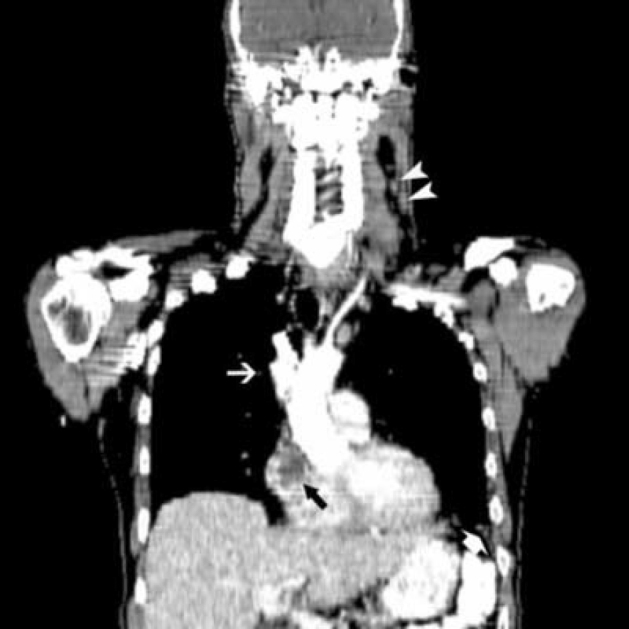 Figure 1C