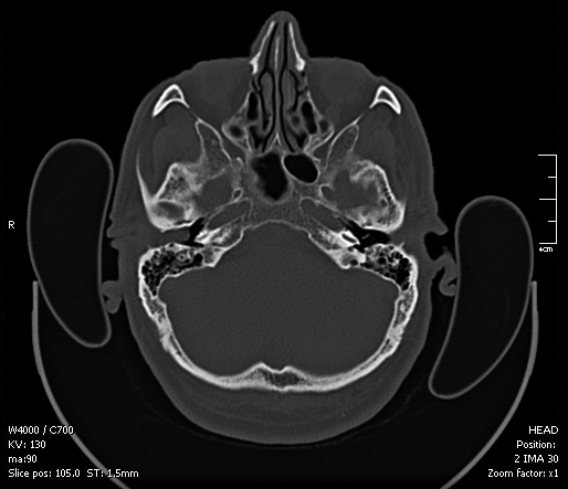 Fig. 1.