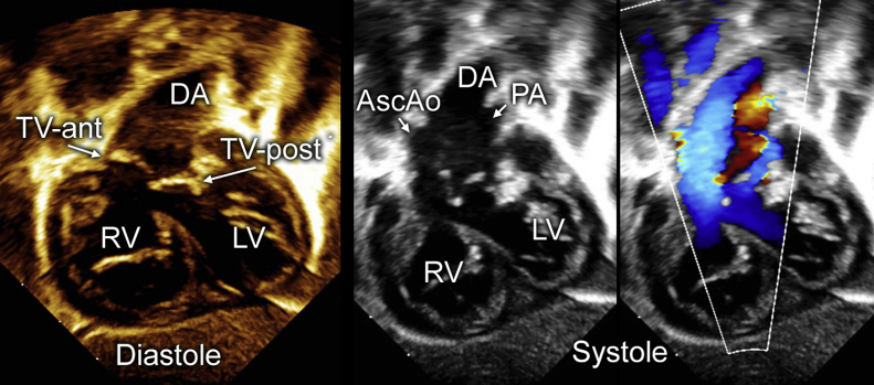 Figure 2