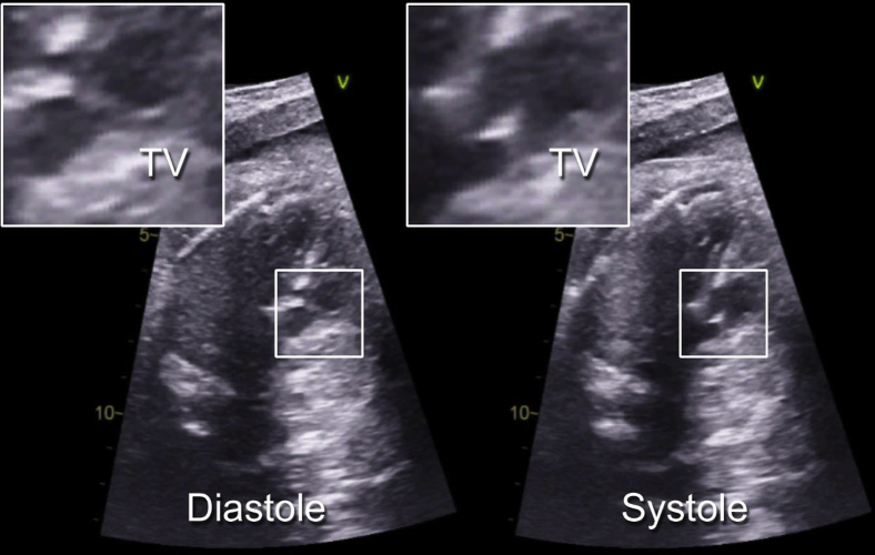 Figure 1